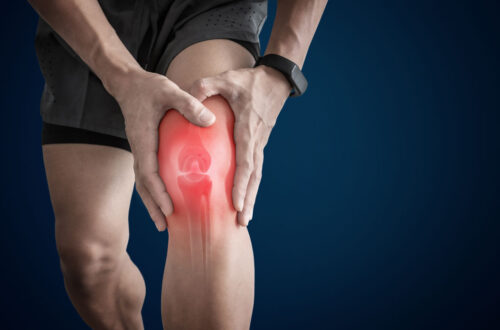 Apa Itu Ligamen ACL