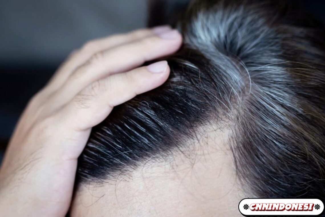 6 Penyebab Rambut Beruban pada Pria dan Wanita Muda