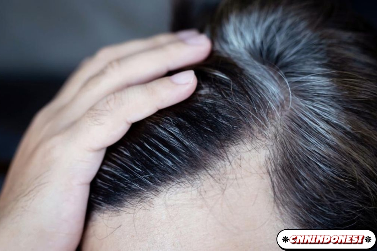 6 Penyebab Rambut Beruban pada Pria dan Wanita Muda